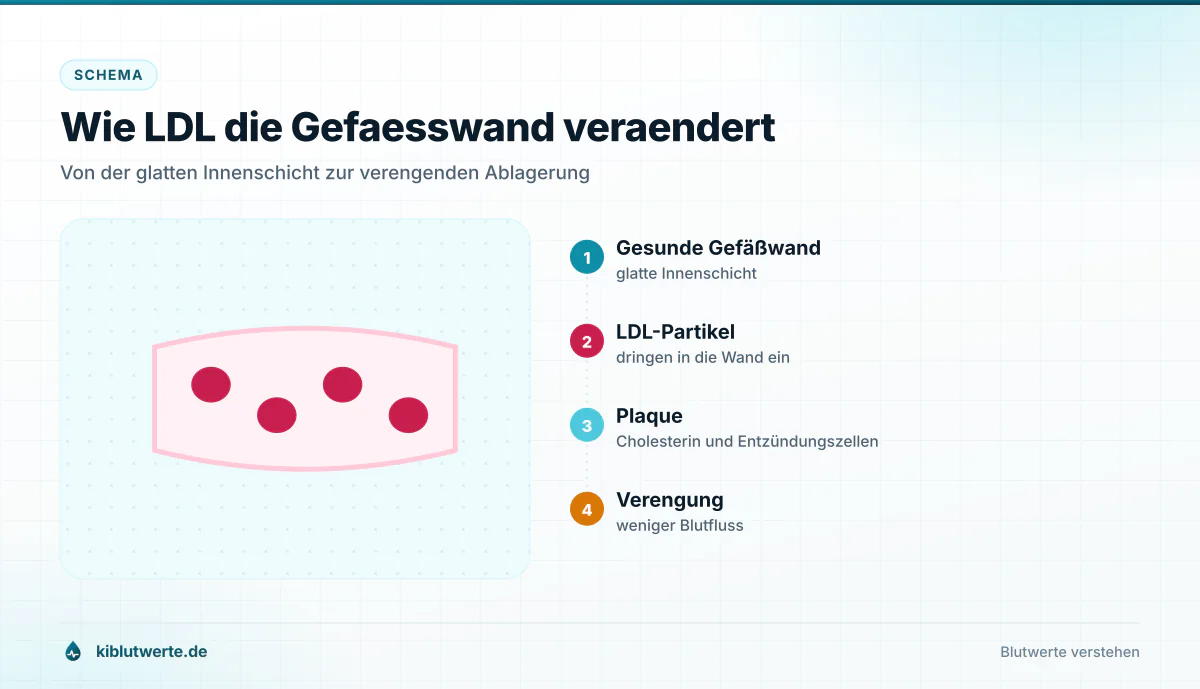 Wie LDL die Gefaesswand veraendert Schematischer Querschnitt eines Blutgefäßes mit eingelagerten LDL-Partikeln, wachsender Plaque und verengtem Gefäßinneren