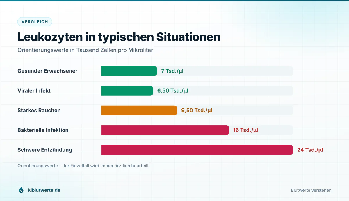 Leukozyten in typischen Situationen Balkendiagramm mit Leukozytenwerten bei Gesunden, viralem Infekt, Rauchen und bakterieller Infektion